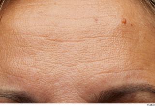 HD Face Skin Thelma Tigger forehead skin pores skin texture…